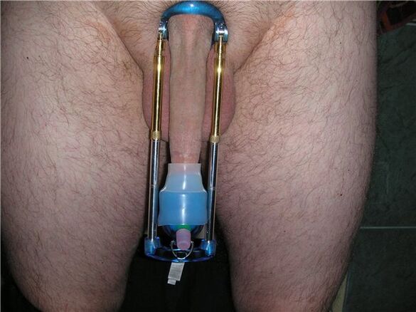 Extender - a device for penis enlargement
